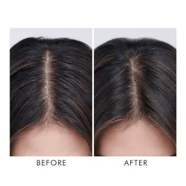 Tratament pentru scalp gras 15x10 ml. / Maroccanoil Tratament pentru scalp gras